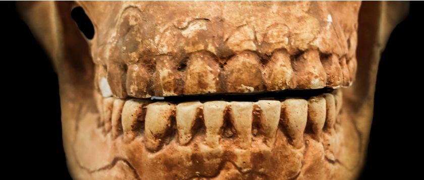 Los Neanderthales iban al dentista.