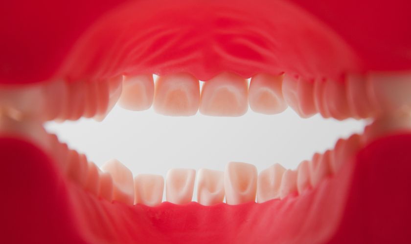 ¿Por qué se desgastan los dientes?.