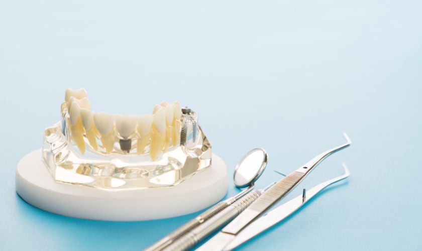 Tratamiento de ortodoncia e implantes.