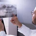 ¿Cómo afecta la osteoporosis a la salud de tus dientes? | Odontólogo valorando radiografía dental