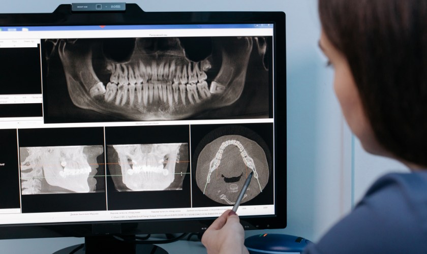 Algunas patologías bucodentales pueden dañar el cerebro: odontóloga examina radiografía de una boca.