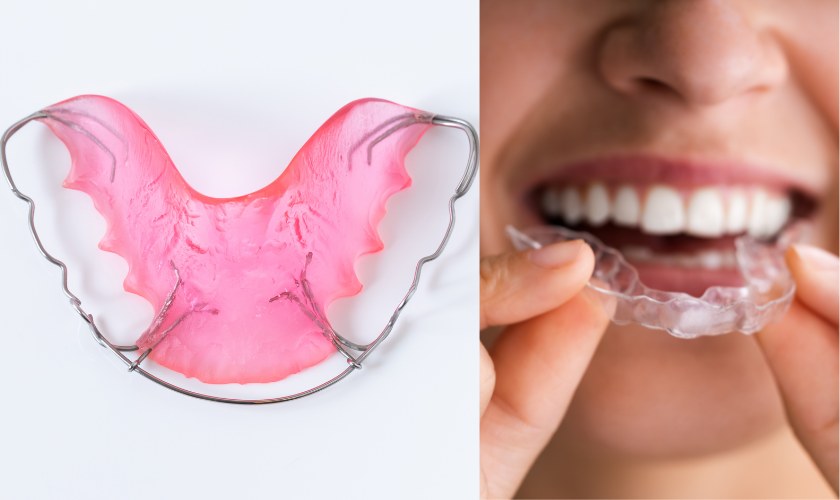 Retenedores dentales removibles: tipo Hawley y transparente.