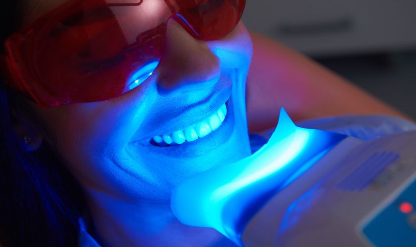 El blanqueamiento dental suele hacerse con luz y gel.