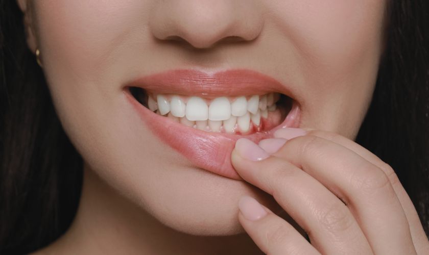 Mujer baja su labio para mostrar encía inferior enrojecida.