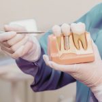 Regeneración ósea guiada para implantes dentales explicada paso a paso